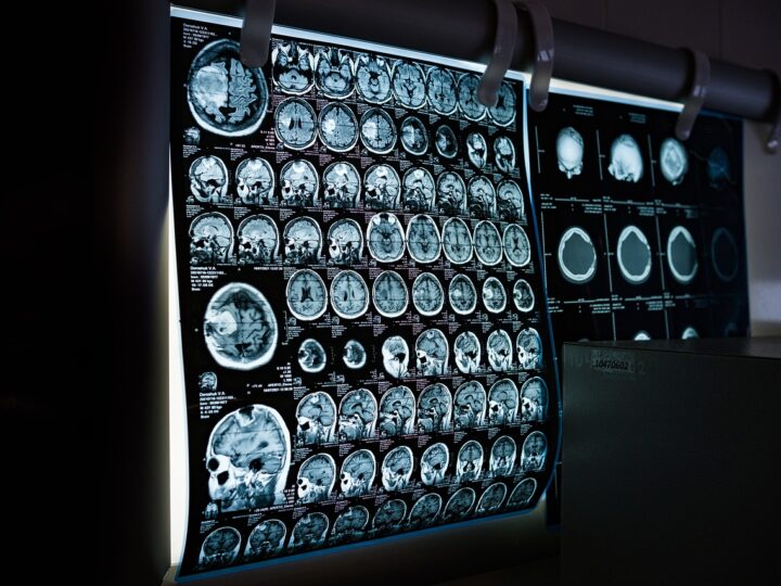 O impacto da inteligência artificial na radiologia