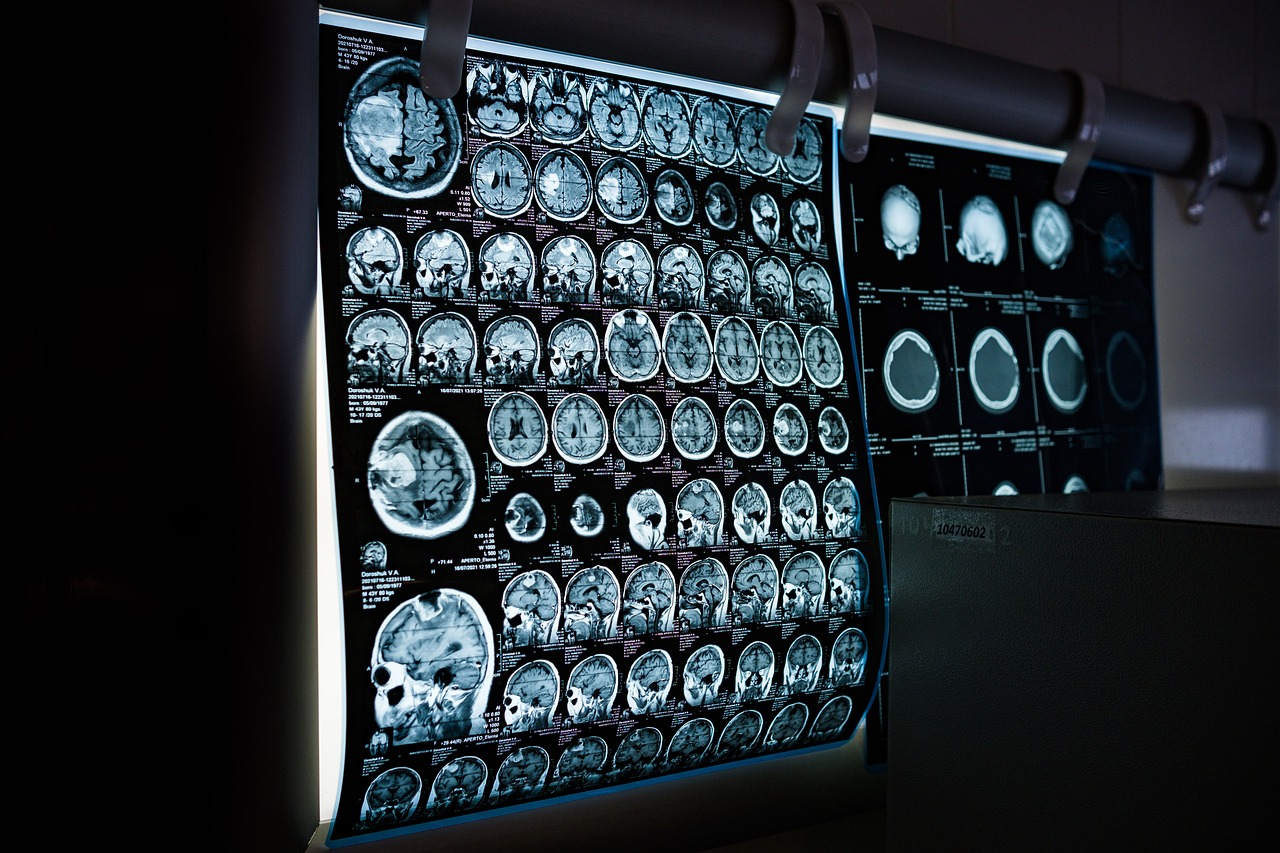 O impacto da inteligência artificial na radiologia