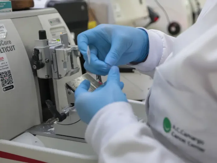 Cura de câncer de próstata pode chegar a até 98%