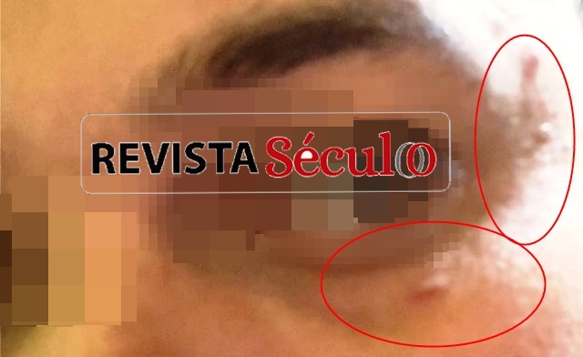Morador é ferido com pedrada após tentar impedir invasão de mendigo em residência no bairro Embratel, em Vilhena